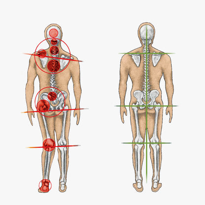 ASCEND™ - Inlegzolen